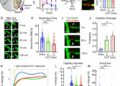 Pericyte dysfunction and loss of interpericyte tunneling nanotubes promote neurovascular deficits in glaucoma