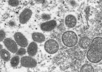 Health officials predict more monkeypox cases, but no widespread outbreak